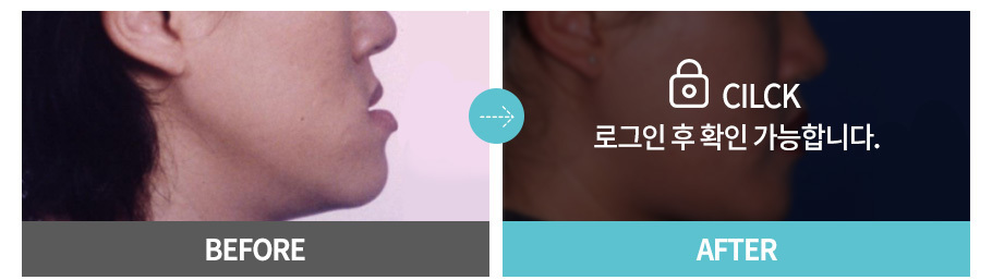 이미지명