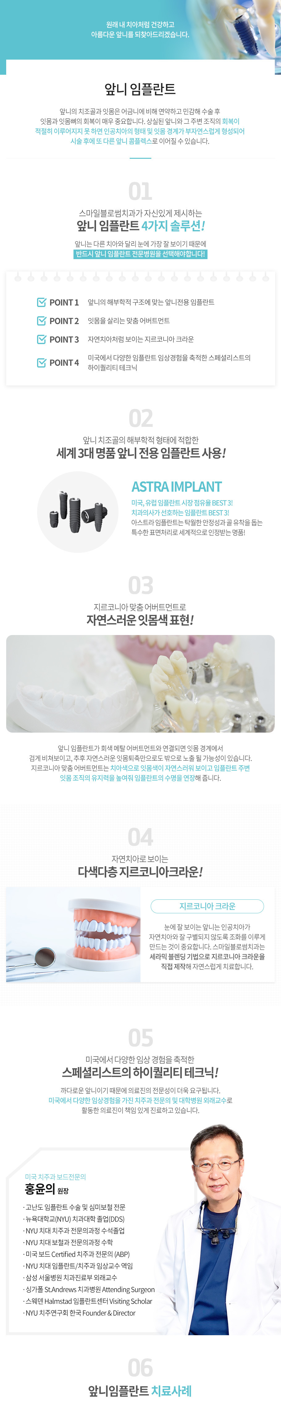 앞니 임플란트