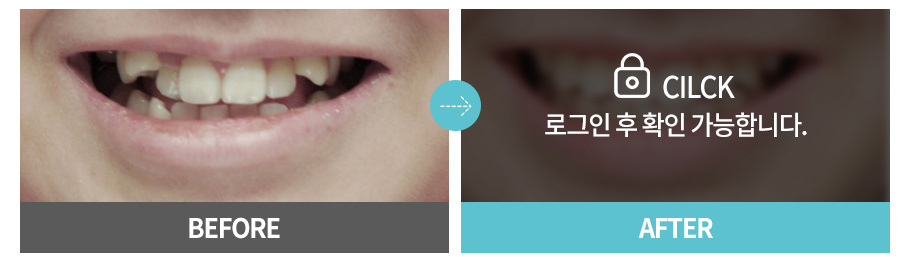 이미지명