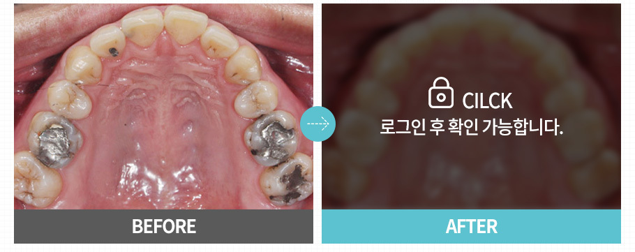 이미지명