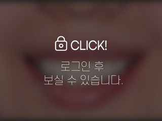 오래된 보철 라미네이트 교체+잇몸성형