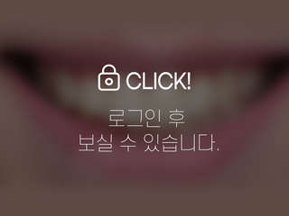 앞니 부분교정 + 무삭제라미네이트(작은 앞니 왜소치)