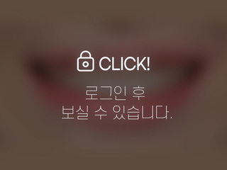 무삭제라미네이트-벌어진 앞니