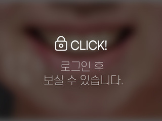 4~6개월 앞니부분교정