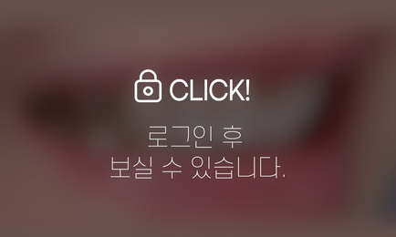 무삭제라미네이트-옥니