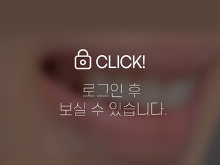 무삭제라미네이트(애드온비니어)- 왜소치