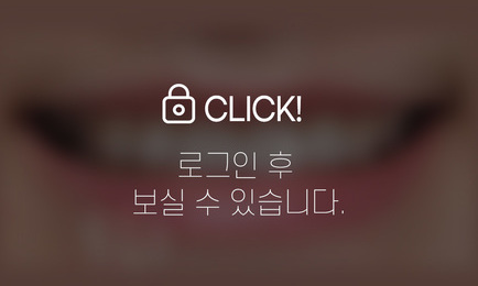 무삭제라미네이트(작고 벌어진 치아)