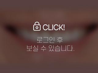 무삭제라미네이트-치아부식, 마모