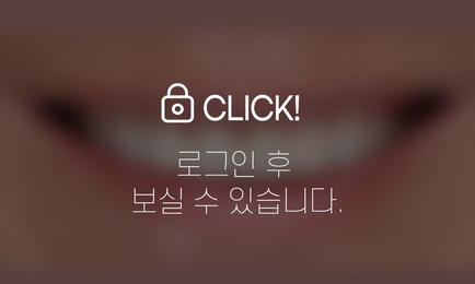 무삭제라미네이트-치아부식, 마모