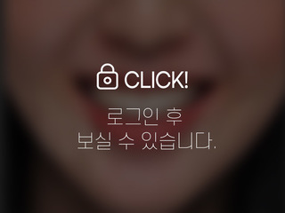 뻐드러진 치아 전체교정