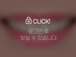 무삭제라미네이트&치조골성형 - 거미스마일 및 작은 치아