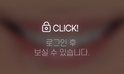 무삭제라미네이트-웃을 때 더 환하게 보이고 싶은 앞니