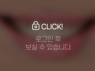 무삭제라미네이트(애드온비니어)-왜소치