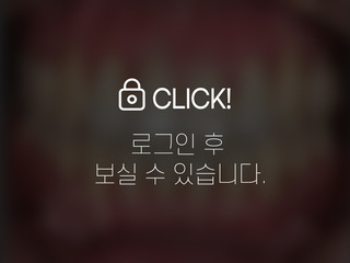 덧니 전체교정 + 잇몸이식술