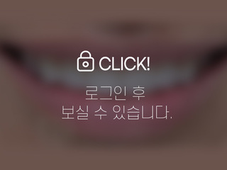 무삭제라미네이트(화이트스팟 부위만 선택적 삭제)