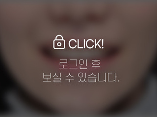 4~6개월 앞니부분교정