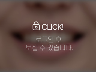 4~6개월 앞니부분교정