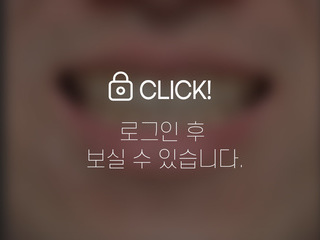 덧니 전체교정