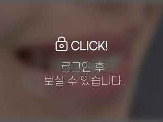 4~6개월 앞니부분교정