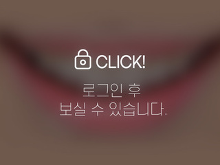 무삭제라미네이트(애드온비니어)-벌어진 앞니
