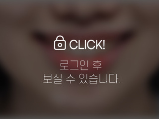 4~6개월 앞니부분교정