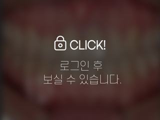 덧니 전체교정