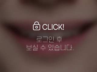 4~6개월 앞니부분교정